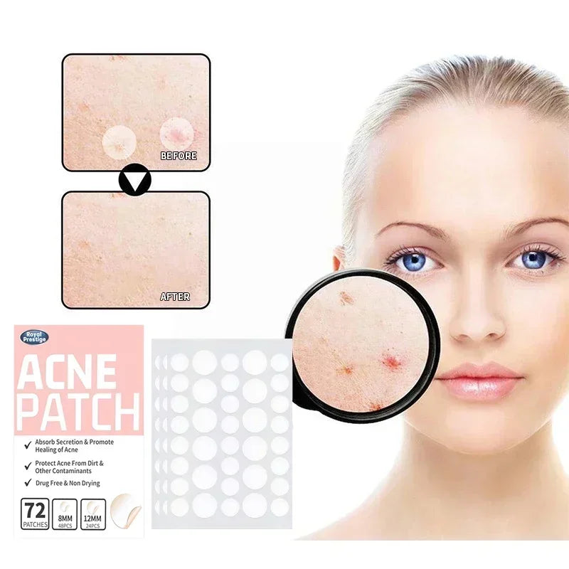 Clear Complexion Acne Patches